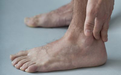 Complications-Caused-By-Flat-Feet