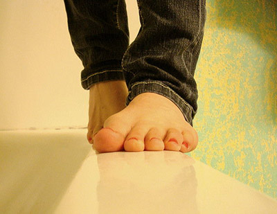 Common-Causes-Of-Flat-Feet
