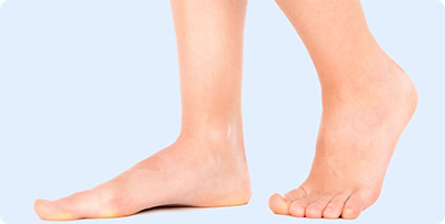 Diagnosing-Flat-Feet