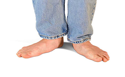 What-Causes-Flat-Feet