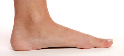 flat-feet