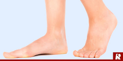 Determining If You Have Flat Feet